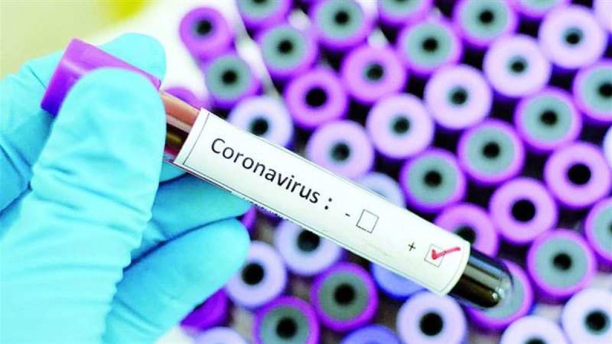 У Запорізькій області з’явилися нові підтверджені випадки інфікування коронавірусом
