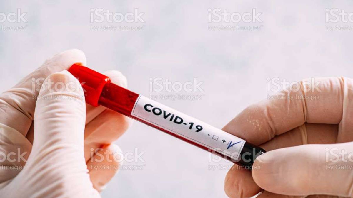 Статистика на 26 октября: covid-19 в Запорожской области