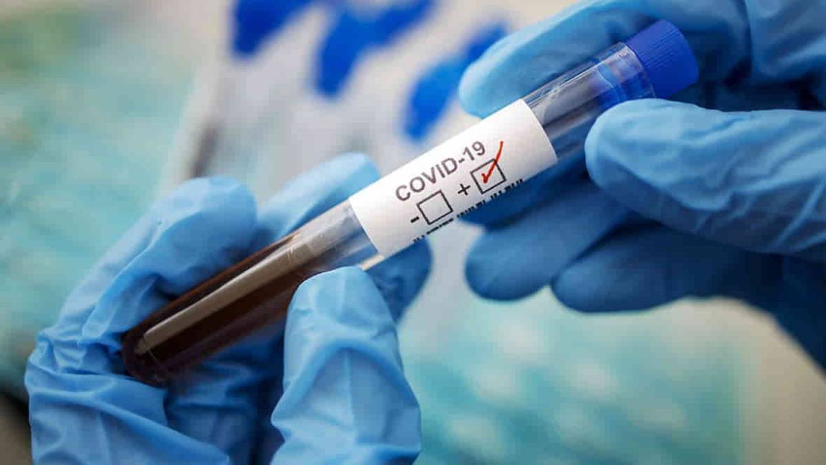 В Запорожской области стремительно растет число новых случаев коронавируса