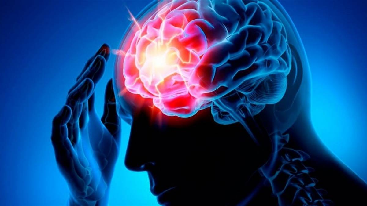 Безоплатні медичні послуги у випадку інсульту під час війни