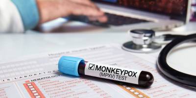 В Україні підтвердили другий випадок мавпячої віспи – МОЗ
