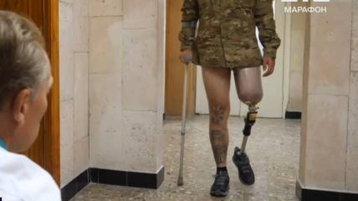 Щонайменше 25 000 українців втратили кінцівки через російське вторгнення, – Sky News