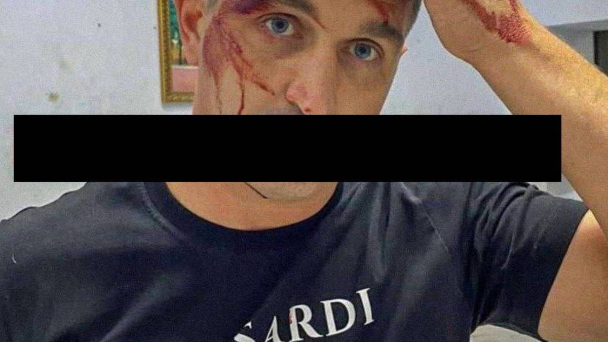 В оккупированном Мариуполе неизвестные ударили ломом по голове российского политика