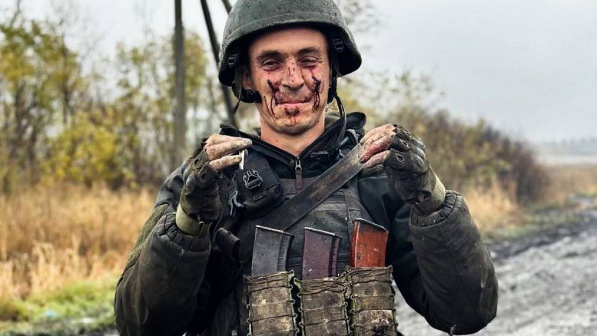 Обличчя війни: захисник запорізького краю гвардієць Андрій після штурму ворожих позицій