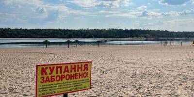 На Запоріжжі – посилений режим епіднагляду за холерою