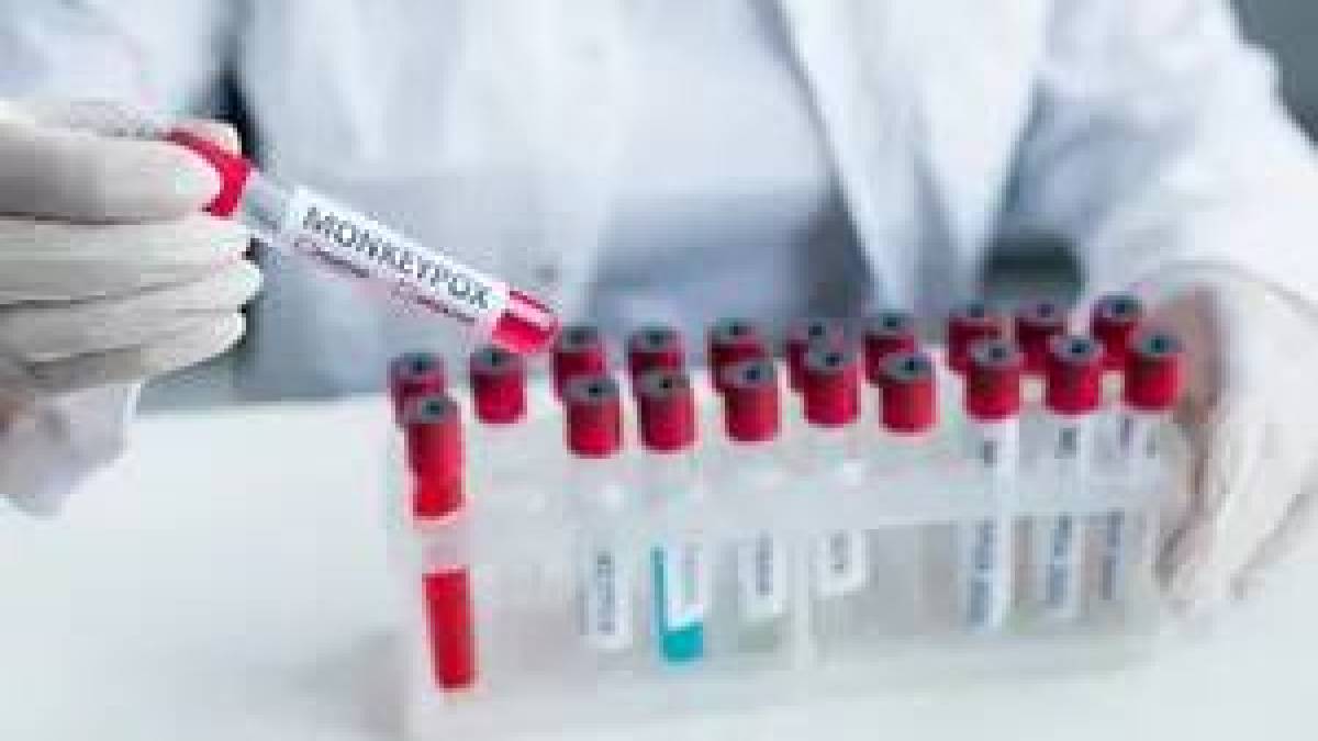ВООЗ підтвердила перший в Європі випадок захворювання віспою мавп