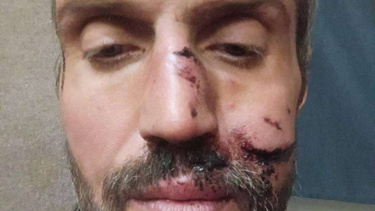 Запорізький журналіст Тарас Василенко три дні провів у російському оточенні