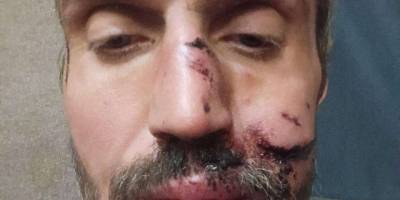 Запорізький журналіст Тарас Василенко три дні провів у російському оточенні