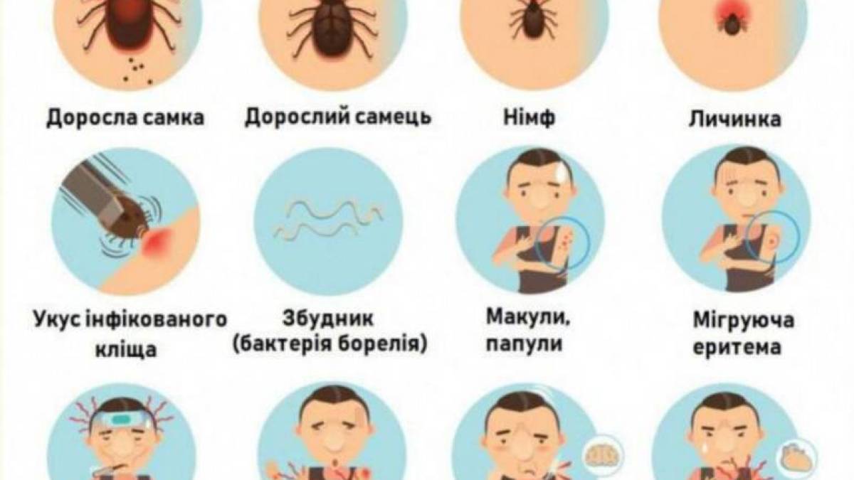 У Запоріжжі 42 людини постраждали через укуси кліщів за тиждень