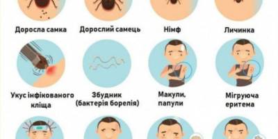 У Запоріжжі 42 людини постраждали через укуси кліщів за тиждень