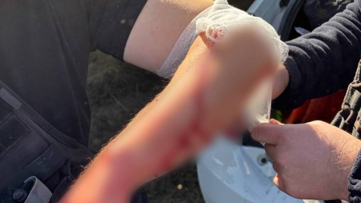 Під час атаки на Запоріжжя двоє патрульних отримали поранення