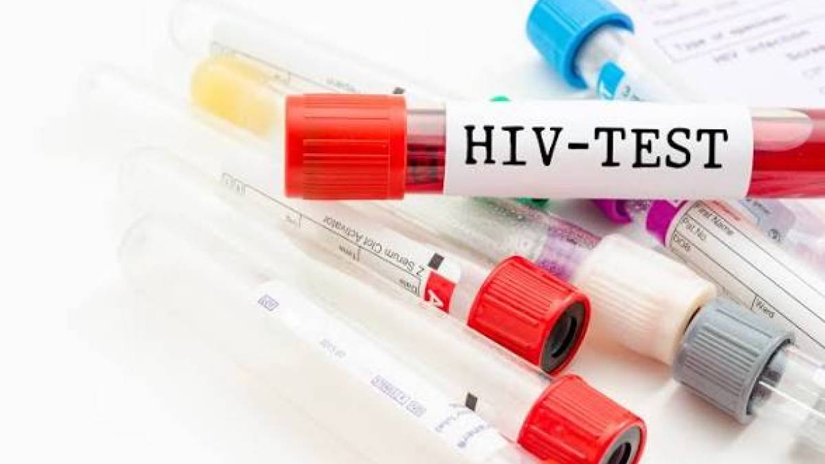 Безкоштовне тестування на ВІЛ і гепатит для евакуйованих у транзитному центрі Запоріжжя